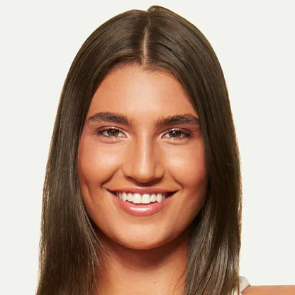 Instantly Fix Your Hairline — No One Will Ever Know‼️